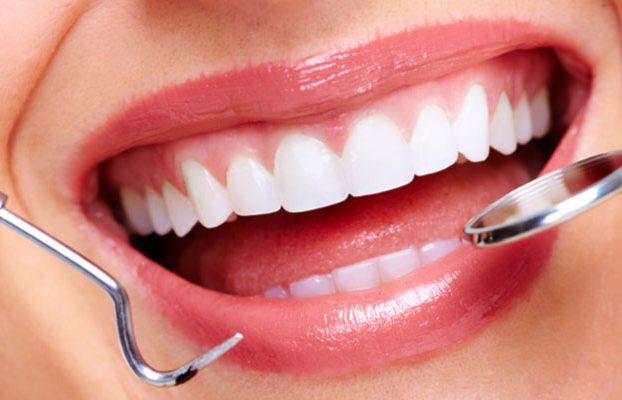 لمینت دندان/ مزایا و معایب لمینت دندان