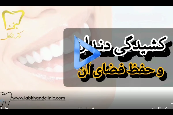 حفظ فضای بین دندان کشیده شده