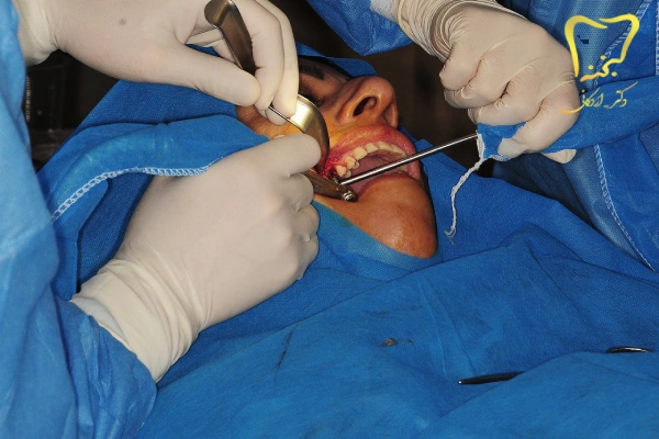 جراحی دندان تخصصی
