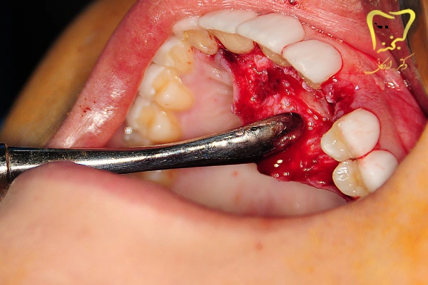 جراحی دهان و دندان
