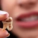 دلایل جراحی دندان عقل چیست؟