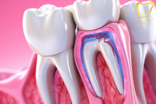 درمان ریشه دندان کرج