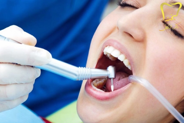 مرکز درمان ریشه دندان کرج