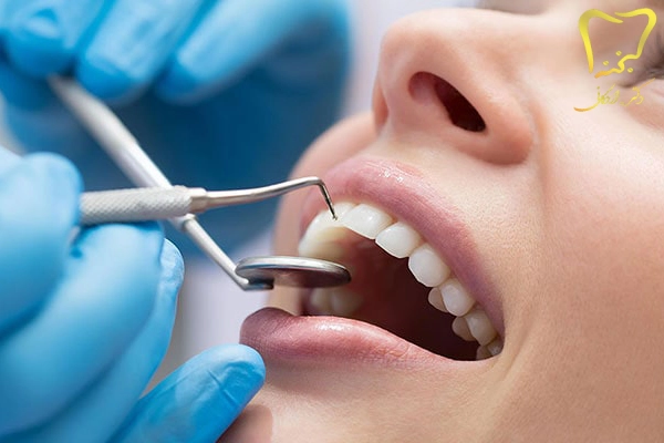پزشک درمان ریشه دندان در کرج