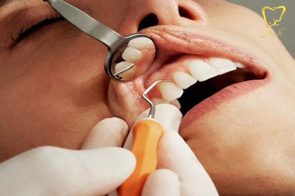 انواع دندانپزشکی بدون درد در کرج