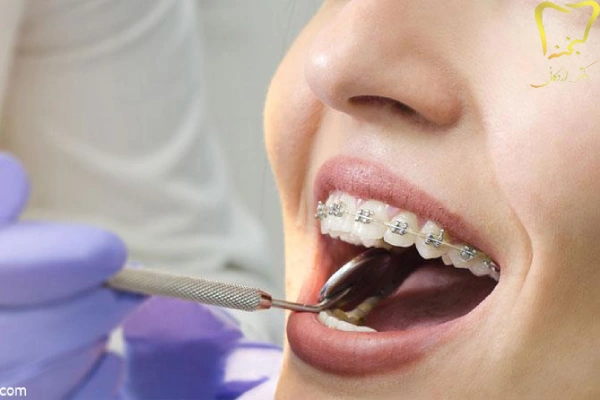 هزینه دندانپزشکی در کرج