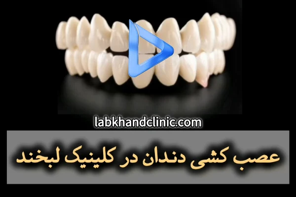 عصب کشی دندان در کلینیک لبخند