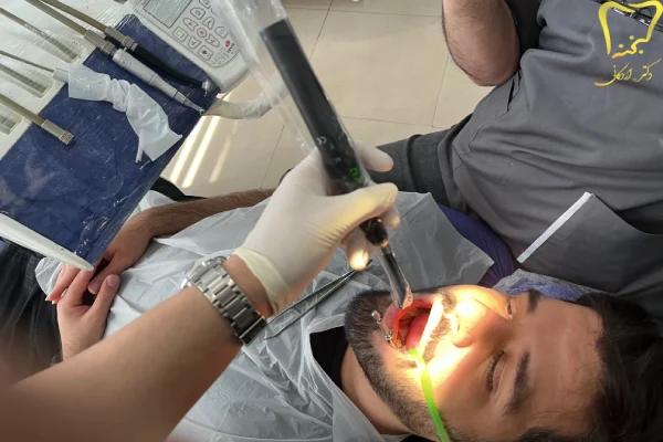  راههای جلوگیری از پوسیدگی بین دندانی