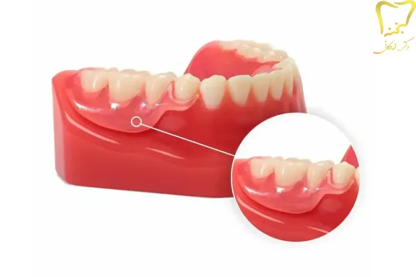 انتخاب نوع پروتز دندان