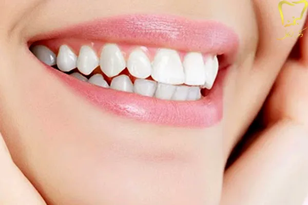 خدمات دندانپزشکی زیبایی در کرج