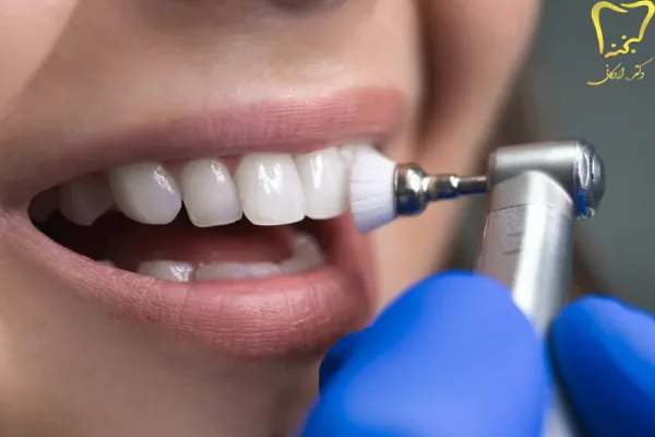 بروساژ دندان
