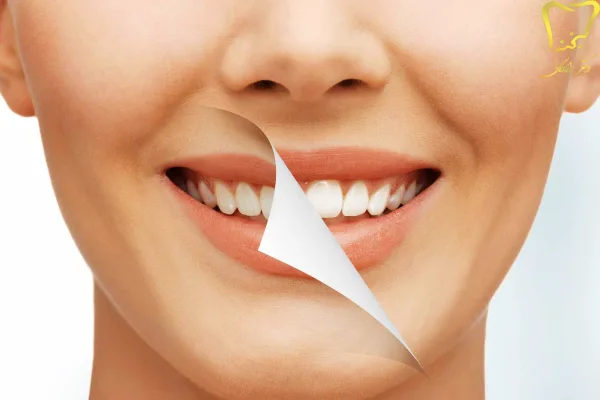 بهترین خدمات دندانپزشکی زیبایی