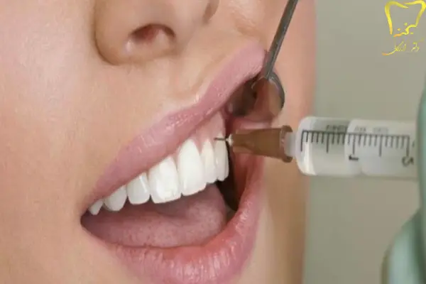 مهمترین انواع جراحیهای دهان و دندان