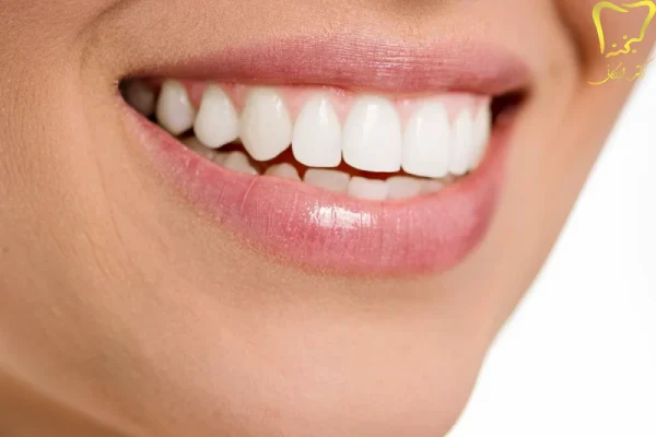 درد دندان روکش شده هنگام جویدن
