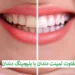 تفاوت بلیچینگ با لمینت دندان چیست؟