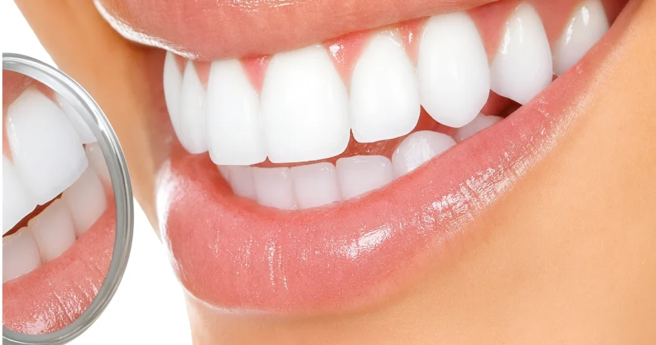 لمینت دندان های کج