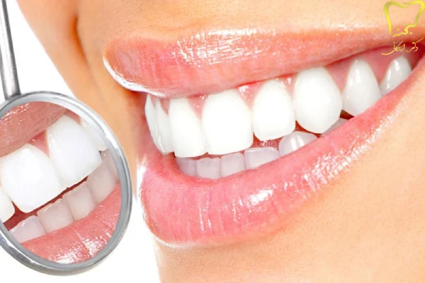 بهترین روش برای سفید کردن دندان ها
