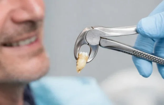 بهترین جایگزین دندان کشیده شده چیست؟