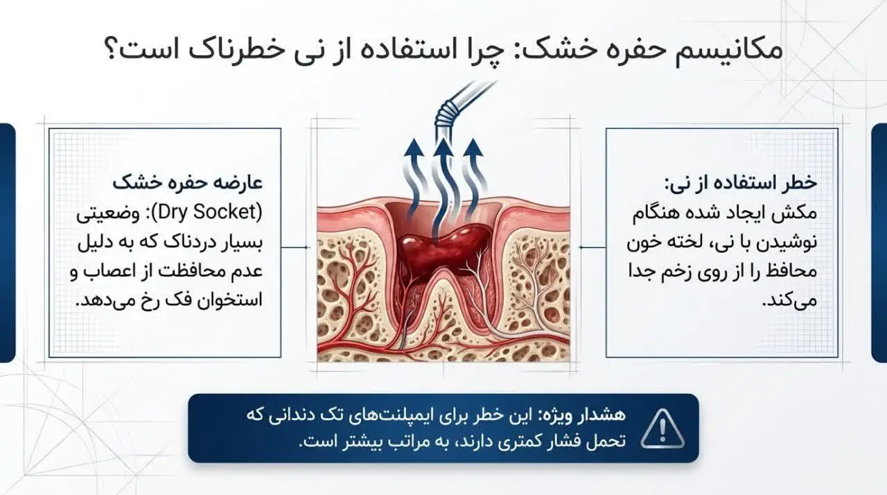 استحمام بعد از ایمپلنت دندان