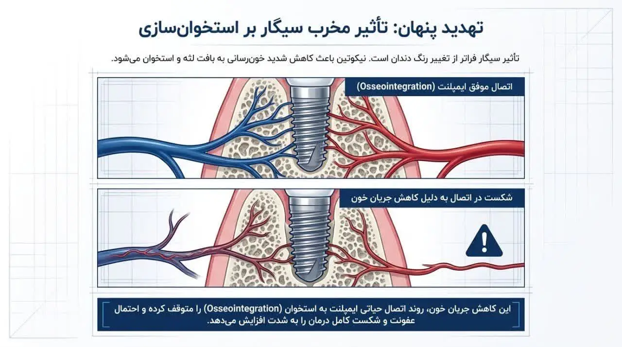خونریزی بعد از ایمپلنت دندان