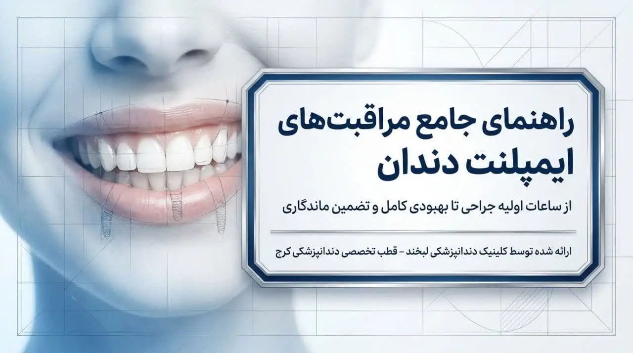مراقبت های بعد از ایمپلنت دندان: راهکارهایی از ابتدا تا بهبود کامل