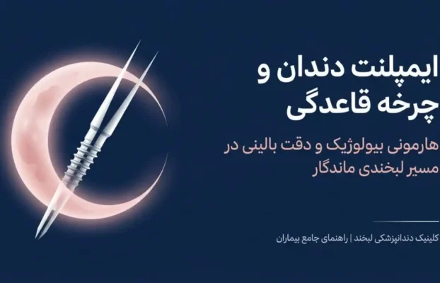 ایمپلنت دندان در زمان پریود