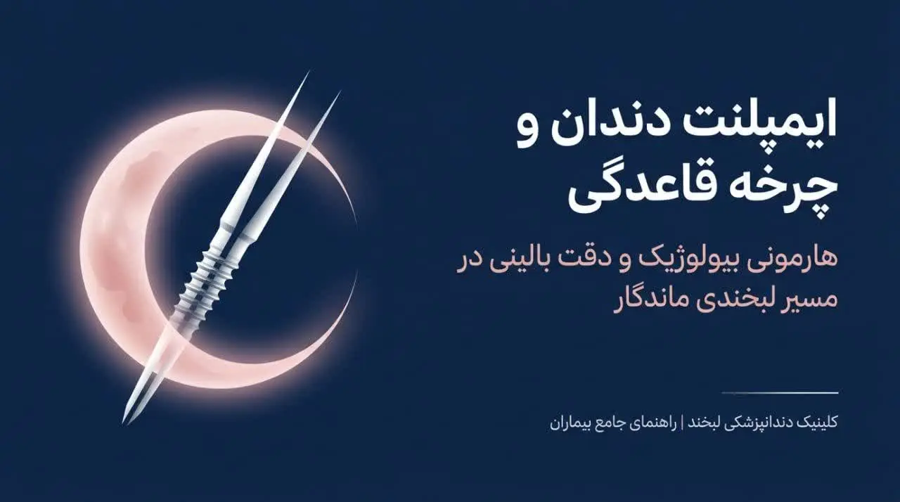 ایمپلنت دندان در زمان پریود