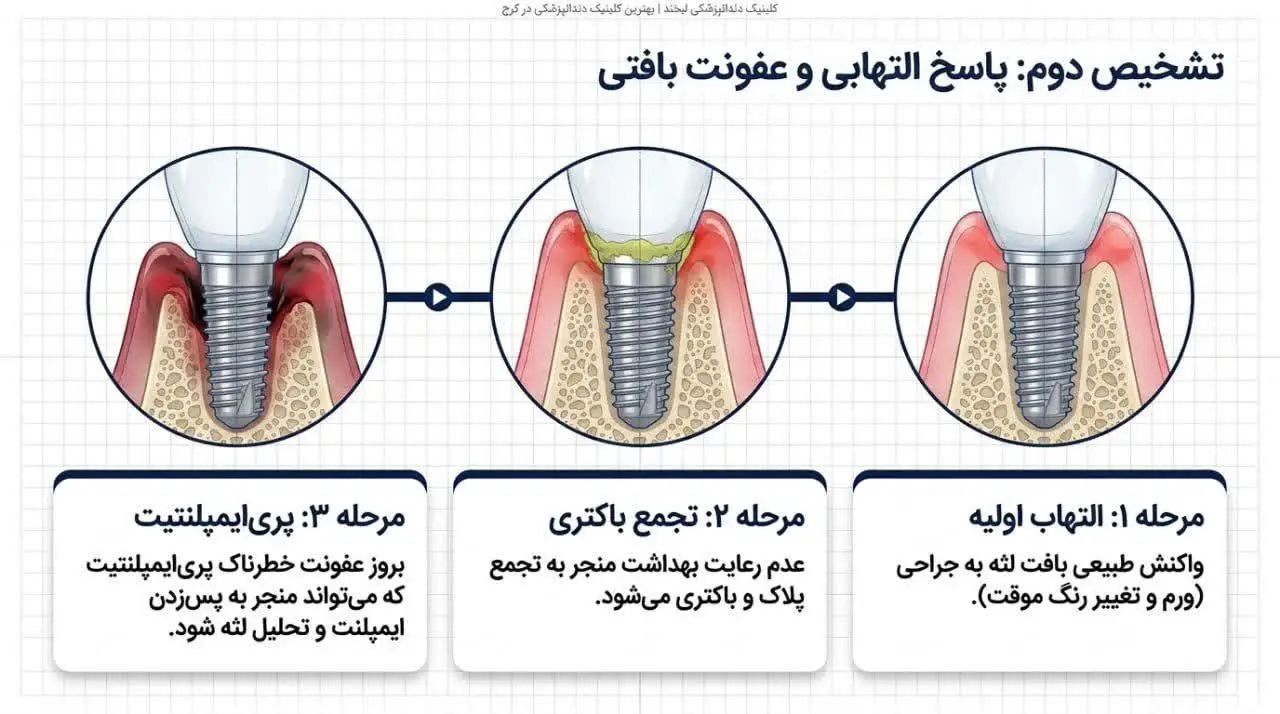 روشهای درمانی برای رفع سیاهی لثه