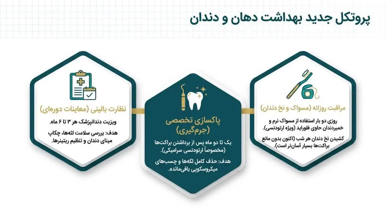 استفاده از نگهدارنده (ریتینر) پس از ارتودنسی