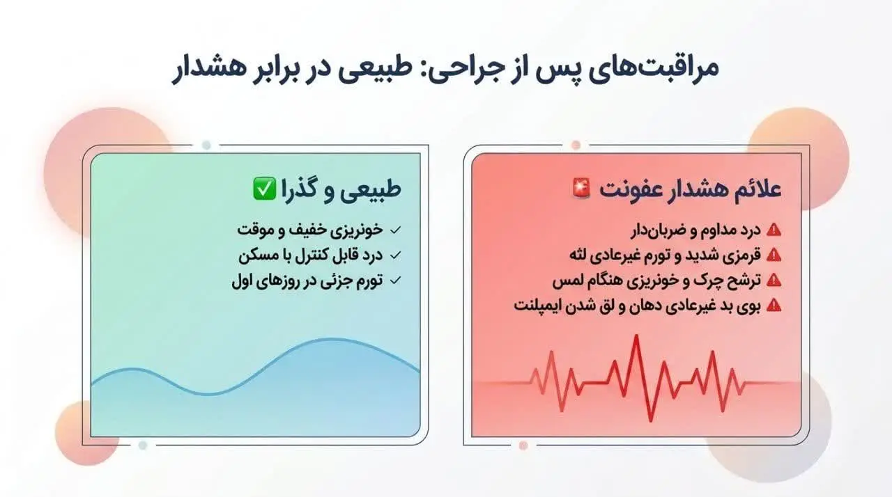 بهترین زمان برای جراحی ایمپلنت در زنان چیست؟
