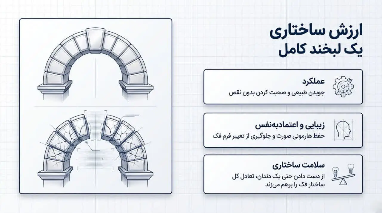 روکش یا ایمپلنت، کدام یک بهتر است؟