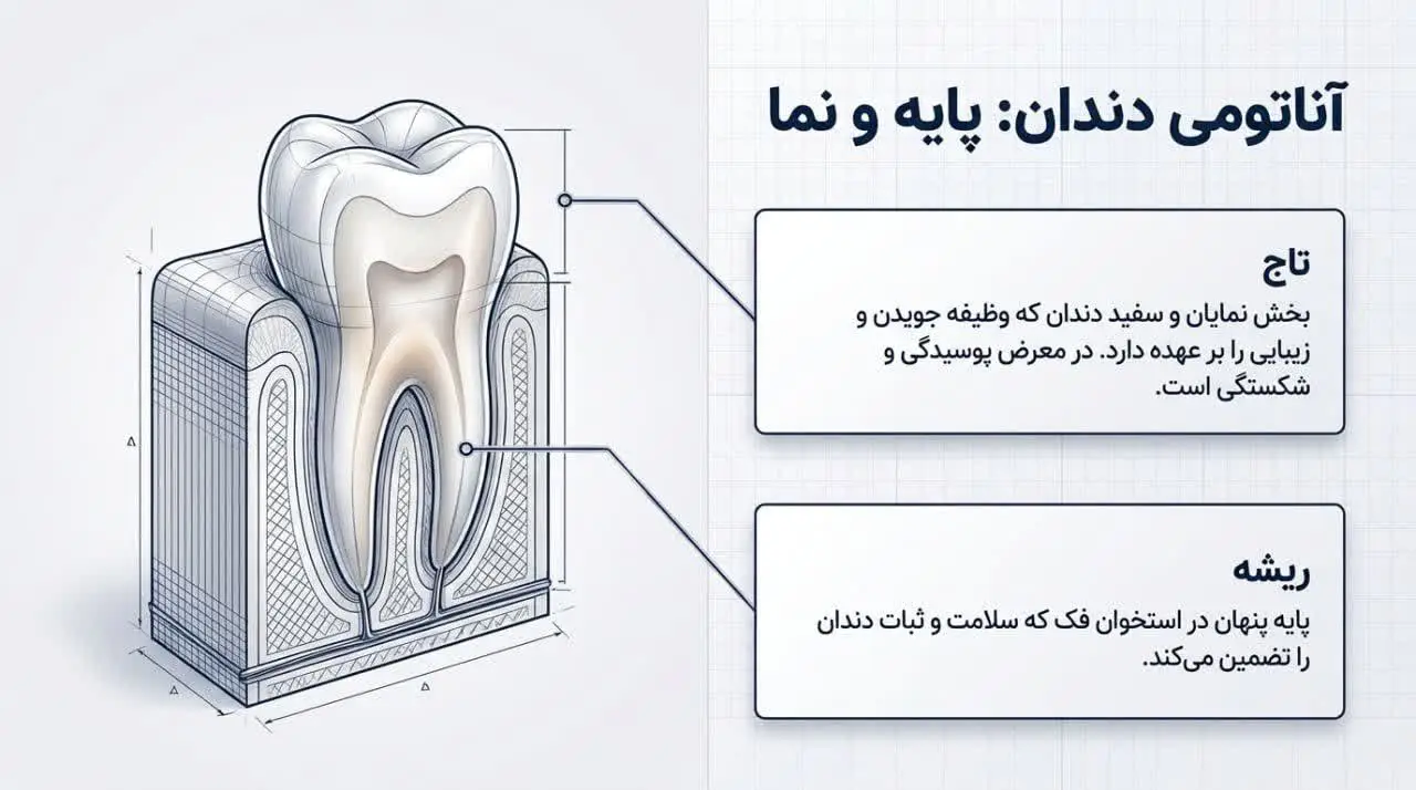 مهمترین تفاوتهای ایمپلنت و روکش