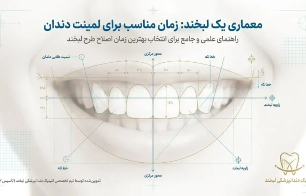 سن مناسب لمینت دندان