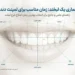 سن مناسب لمینت دندان
