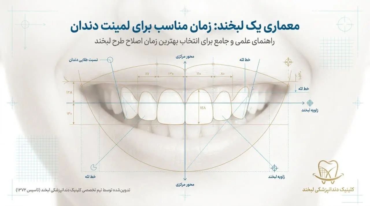 سن مناسب لمینت دندان