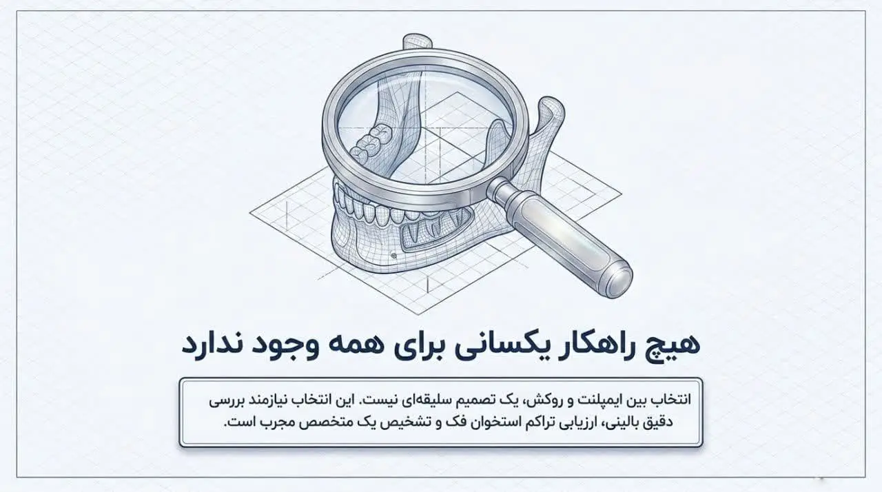 تفاوت روکش و ایمپلنت