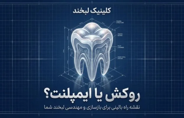 فرق روکش دندان با ایمپلنت؛ کدام انتخاب برای شما مناسبتر است؟