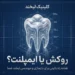 فرق روکش دندان با ایمپلنت