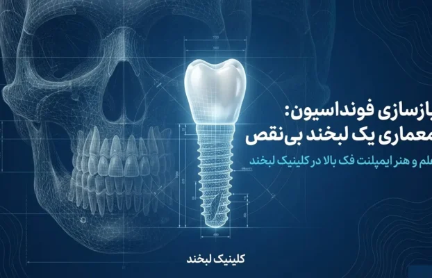 ایمپلنت فک بالا در ماهدشت