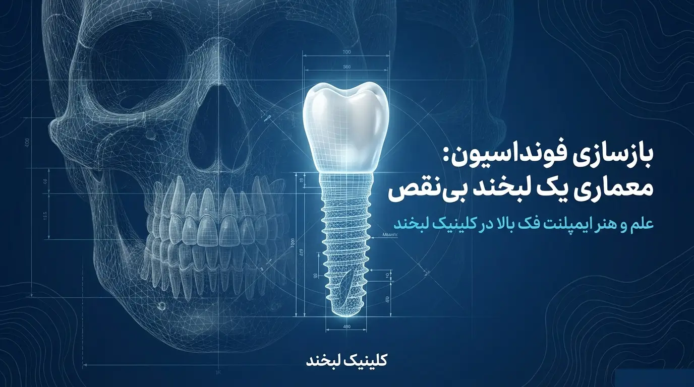 ایمپلنت فک بالا در ماهدشت